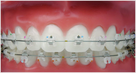 冷光牙齒美白機